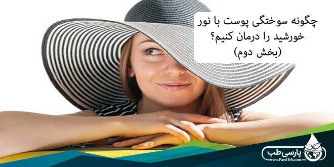 آفتاب سوختگی: چگونه سوختگی پوست با نور خورشید را درمان کنیم؟ (بخش دوم)