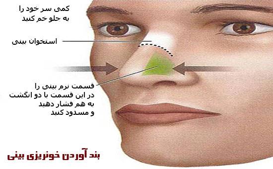 12 اشتباه رایجی که معمولا در انجام کمک های اولیه مرتکب می شویم