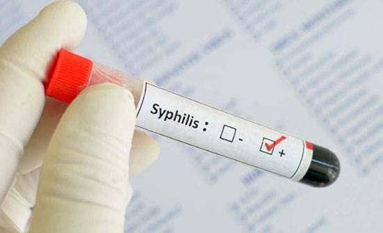 بیماری سیفلیس، احتمال ابتلا به ایدز را 4 برابر می‌کند