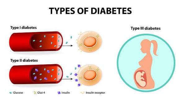 بیماری دیابت