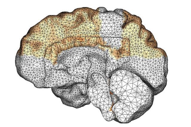 مدل‌سازی رایانه‌ای رشد آلزایمر در مغز+فیلم