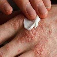 افزایش ابتلا به اگزما در افراد دارای پوست خشک در فصل سرما