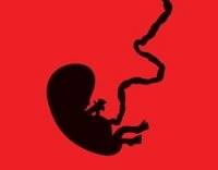 سقط مکرر 2 تا 5 درصد زنان در سنین باروری