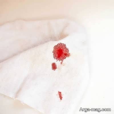 تمیز کردن لکه خون با 7 روش ساده و کاربردی