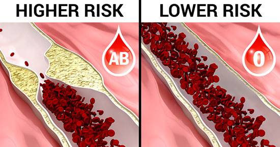 گروه خونی o؛ خطرات، فواید و رژیم غذایی مخصوص آن
