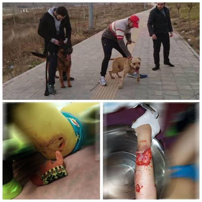 حمله وحشیانه سگ‌ها به یک کودک در لواسان/صاحبان سگ: هیچ کاری نمی‌توانید بکنید!