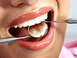 این عادت اشتباه دلیل پوسیدگی دندان شماست!