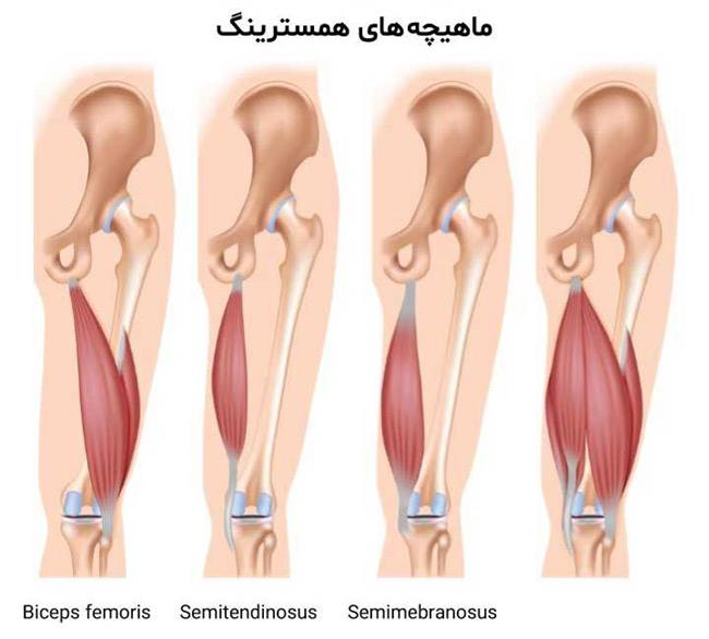 درد پشت زانو