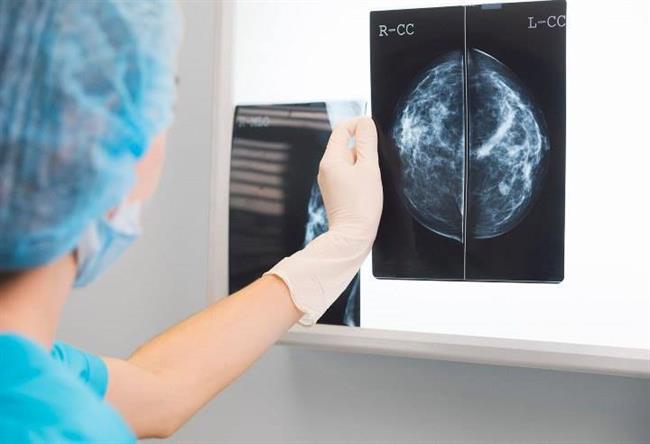 استفاده از ماموگرافی برای تشخیص علت درد سینه