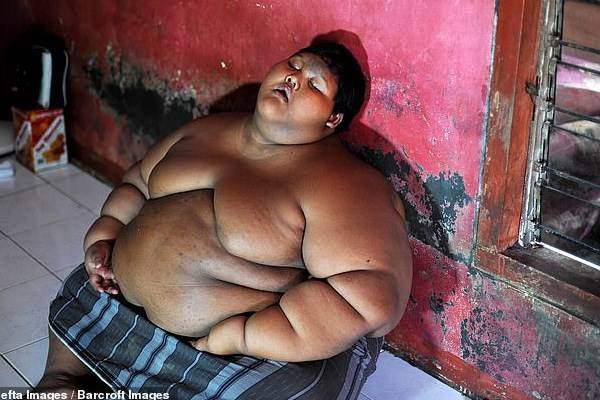 چاق‌ترین کودک جهان پس از لاغری+عکس