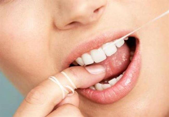 رعایت بهداشت دهان مانن مسواک زدن و نخ دندان از راه های کاهش خطر بروز سنگ لوزه است.