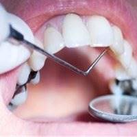 هر 3 سال یک دندان پوسیده به دهان ایرانیان اضافه می‌شود