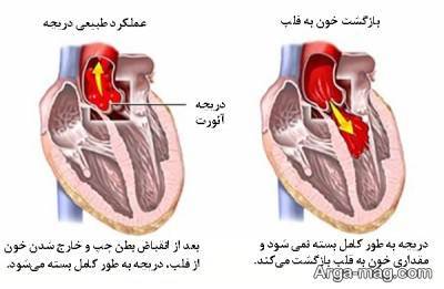 روش های درمان روماتیسم قلبی و علائم و نشانه های این بیماری