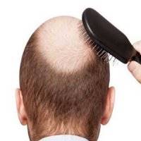 تبلیغ یک فرآورده درمان ریزش موی بدون مجوز در صدا و سیما