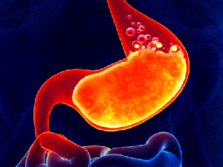توصیه هایی برای روزه داران مبتلا به ریفلاکس معده