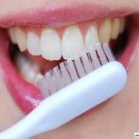 5 درمان خانگی برای پوسیدگی دندان‌