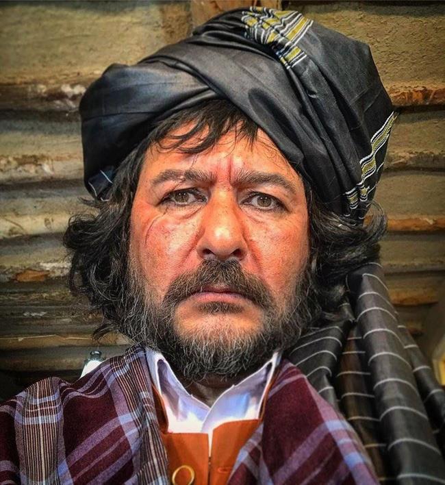 صورت زخمی امیرحسین صدیق در یک فیلم +عکس