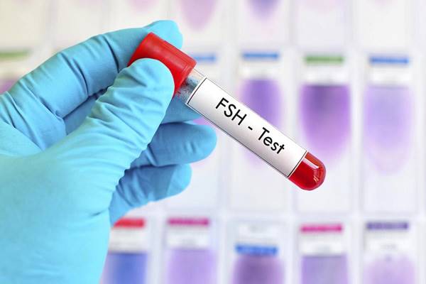 آزمایش هورمون fsh آزمایش هورمون fsh