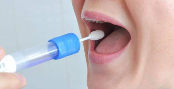آزمایش هورمونی بزاق آزمایش هورمونی بزاق
