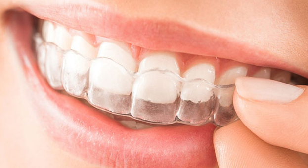 چگونه دندان هایی سالم و زیبا داشته باشیم ؟