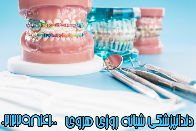 انواع روش های مرتب کردن دندان ها