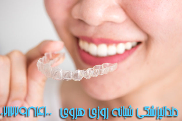 انواع روش های مرتب کردن دندان ها