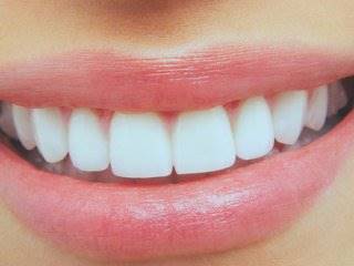 دندان های سفید و زیبا