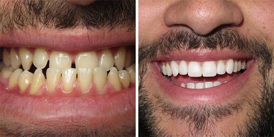 با بهترین راهکارهای زیبایی دندان آشنا شوید