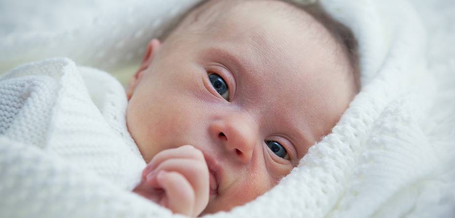 چرا سندرم منکس در نوزادان خطرناک است؟