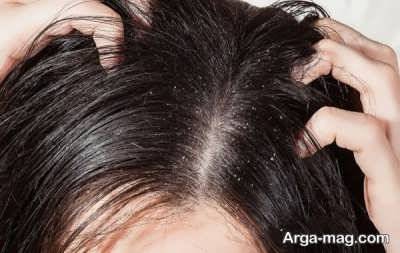 خواص پوست انار بر روی سلامت مو