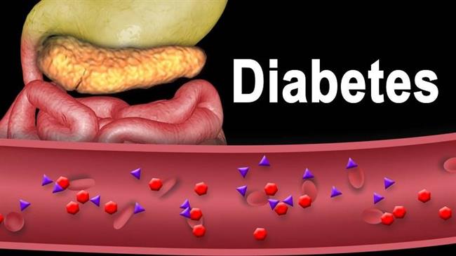 زنگ خطر پیش دیابت و دیابت