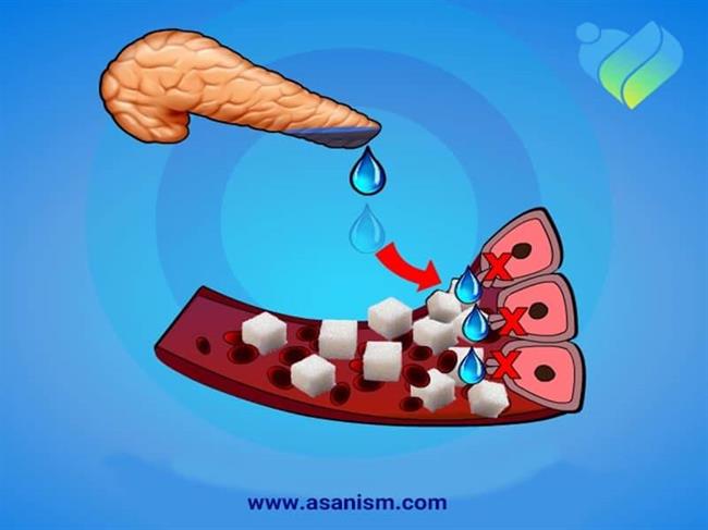 زنگ خطر پیش دیابت و دیابت