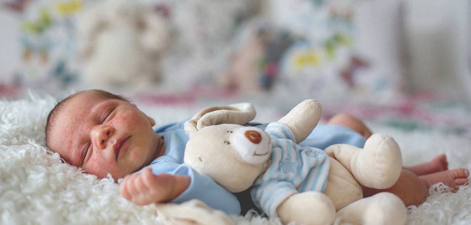 لکه‌های پوستی نوزادان نشانه چه بیماری است؟