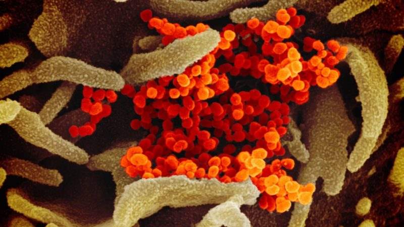 انتشار تصاویر میکروسکوپی ویروس کرونا با ظاهر تاج گونه