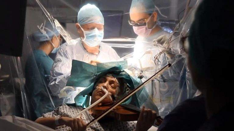 پزشک ایرانی تومور مغزی بیماری را همزمان با ویولون زدن او برداشت [تماشا کنید]