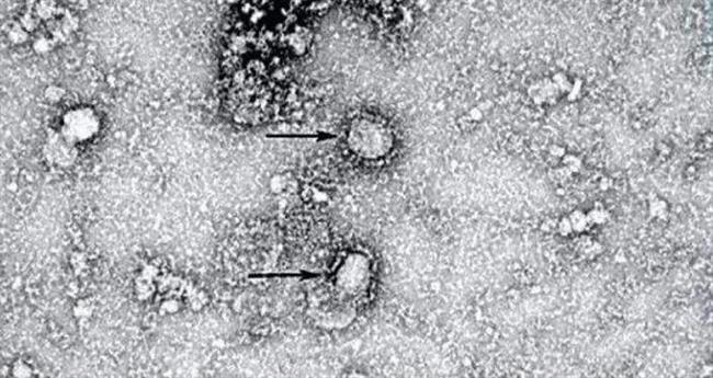 تولید نخستین کیت تشخیص ویروس کرونا در ایران