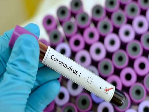 4 سوال بی‌پاسخ درباره ویروس کرونا