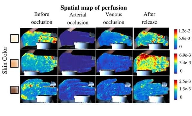 نقشه‌برداری از جریان خون زیر پوست با وضوح بالا