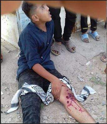 عذرخواهیامام جمعه اهواز از پسر مجروح شده در اعتراضات غیزانیه +عکس