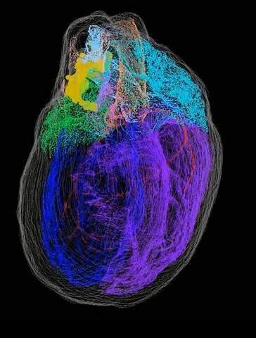 نخستین نقشه 3بعدی از نورون‌های قلب ارائه شد