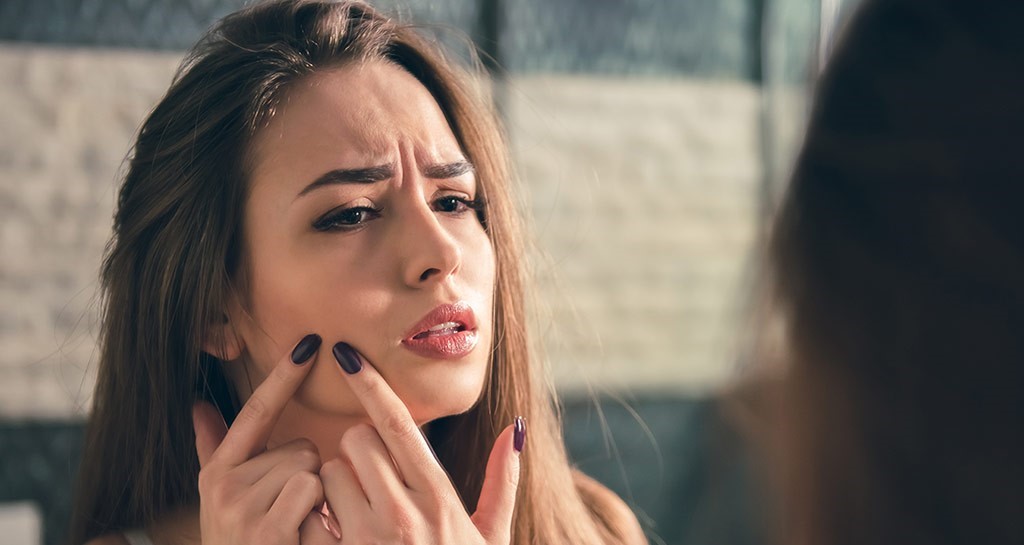 جلوگیری از ایجاد جوش