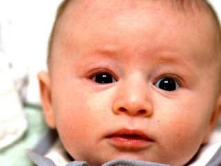 دانستنی ‌های‌ مهم پیرامون انحراف چشمی در بچه‌های نارس