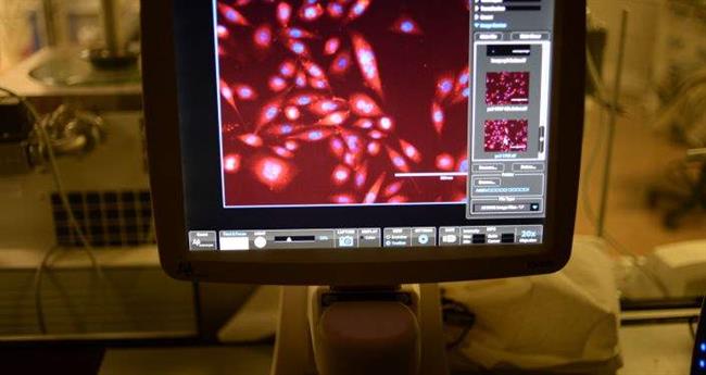 از بین بردن سلول های سرطانی با نانو ذرات