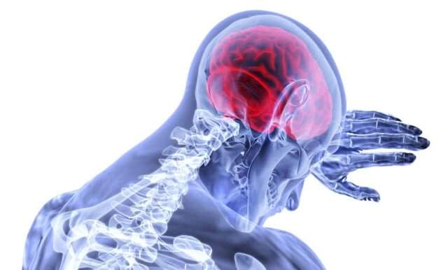 توسعه مدل مافوق ارتجاعی برای درک صدمات مغزی