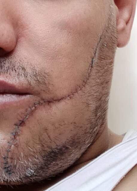 ماجرای حمله به قهرمان بوکس با سلاح سرد +عکس