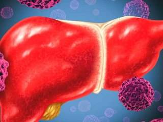 با بزرگترین دشمنان کبد آشنا شوید