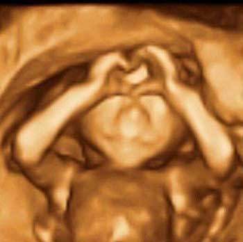 ژست جالب نوزاد در زمان سونوگرافی