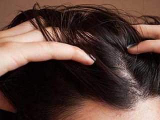 روش‌های جلوگیری از چرب شدن موی سر