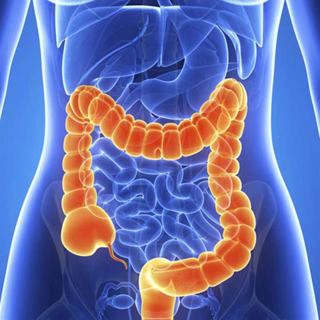 6 نشانه خاموش سرطان روده بزرگ