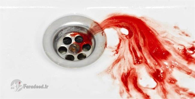 دلایل خونریزی گلو چیست؟